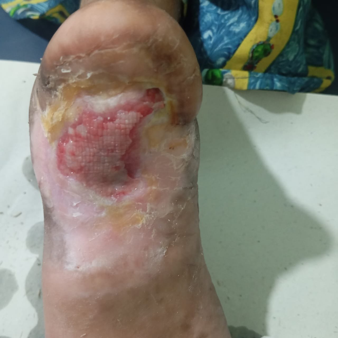 After Image